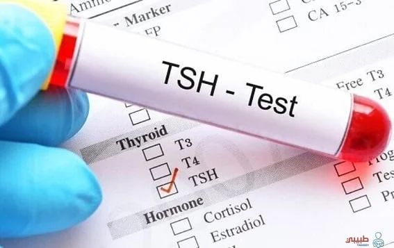 اعراض ارتفاع هرمون الغدة الدرقية tsh: هرمون الغدة الدرقية الـ “Tsh” أهم هرمونات الغدة الدرقية