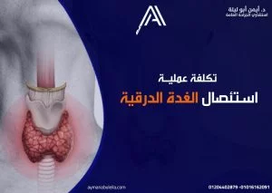 افضل دكتور جراحة عامة في القاهرة: عملية استئصال الغدة الدرقية بالمنظار