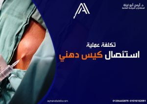 افضل دكتور جراحة عامة في القاهرة: عملية إزالة الكيس الدهني
